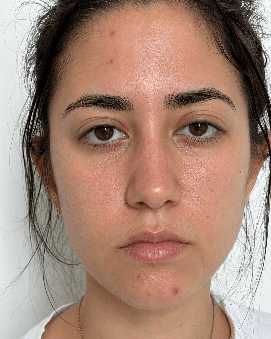Oily skin — input photo