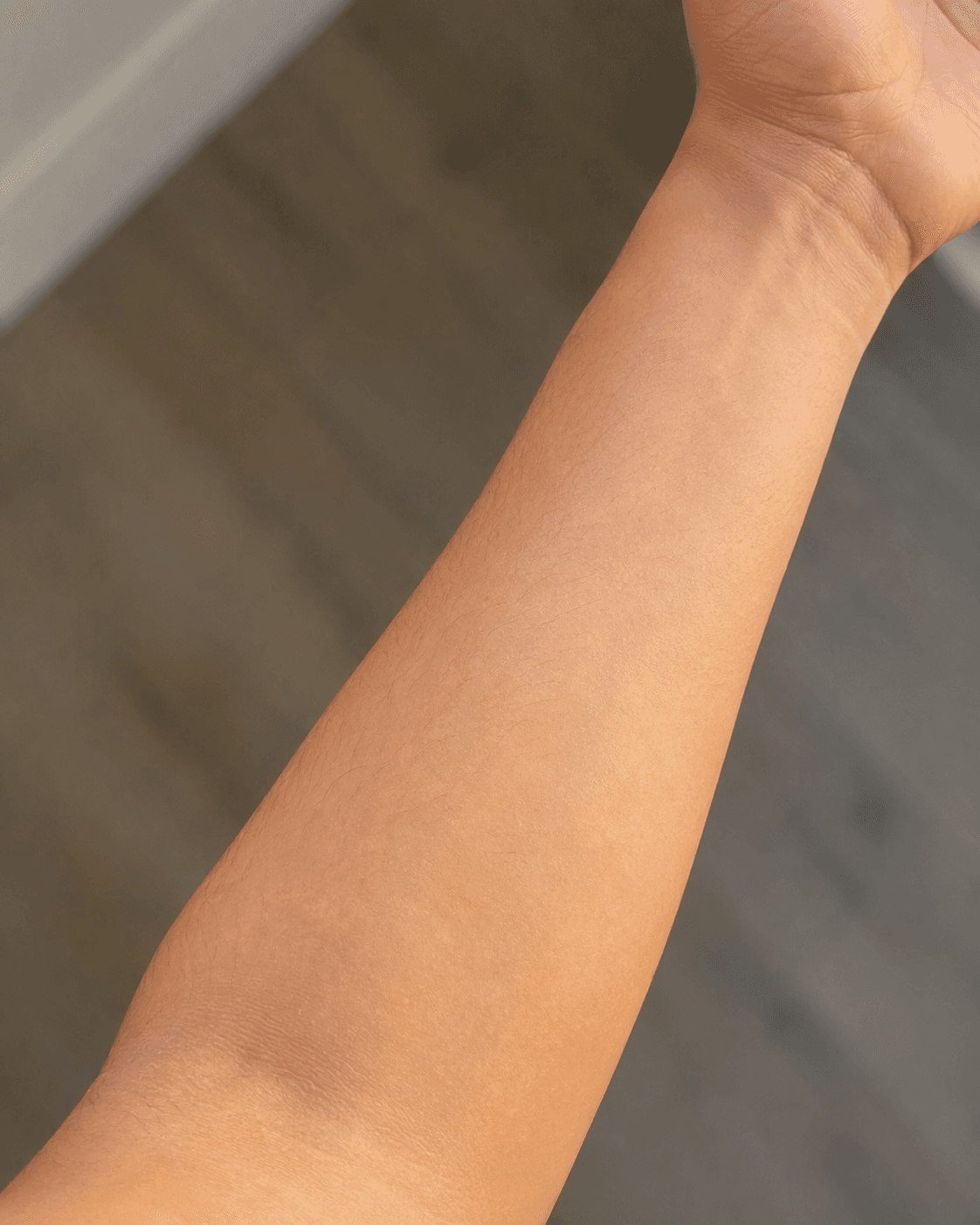 Forearm skin